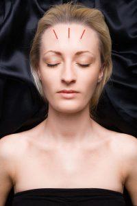 Kosmetisk akupunktur kursus