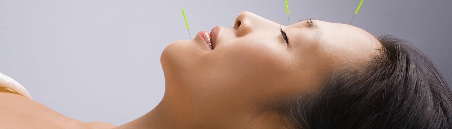 Kosmetisk Akupunktur
